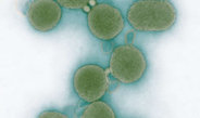 Um biologische Systeme zu entwerfen und zu konstruieren, wollen einige Bioingenieure zunächst die komplexe Natur von Zellen vereinfachen. Sie halten es für notwendig, existierende Organismen in ihrer genetischen Ausstattung auf ein lebensnotwendiges Minimum zu reduzieren.