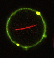 Künstliches Vesikel mit einer Lipidhülle (grün). Injizierte Moleküle des Stützproteins Aktin lagern sich im Innern zu langen Fasern zusammen (rot) und bilden so ähnlich wie in natürlichen Zellen eine Art Stützskelett.